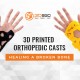 3D Printed Orthopedic Casts
