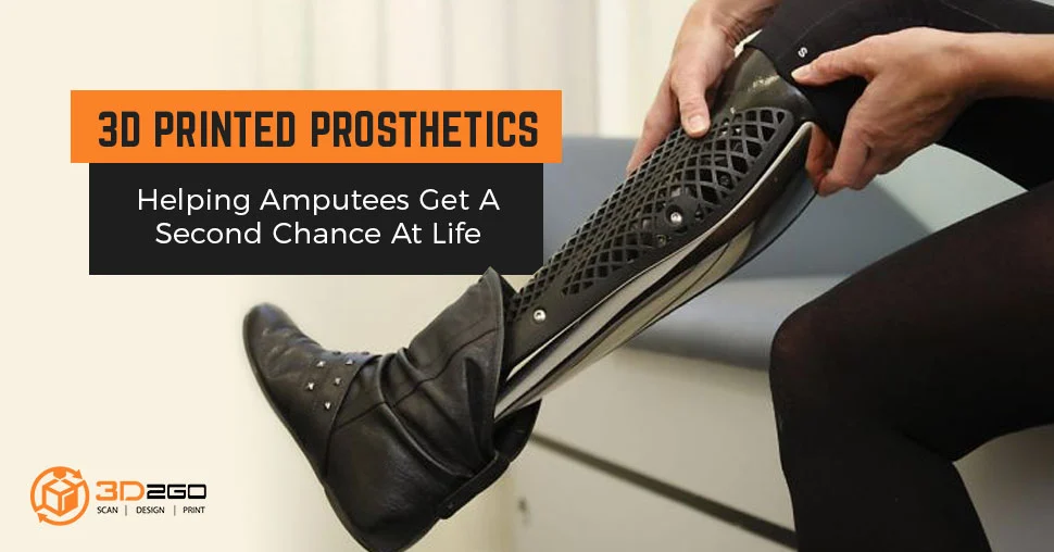 3D Printed Prosthetics
