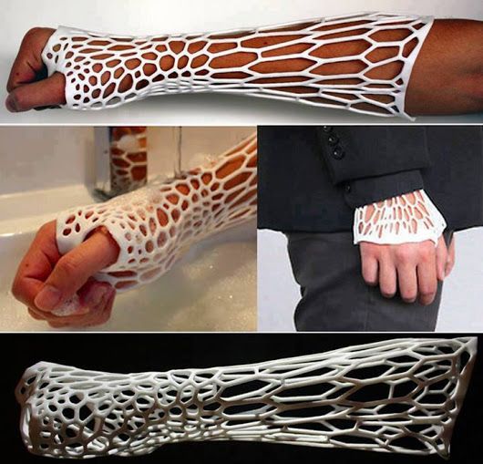 3D printed orthpedic cast