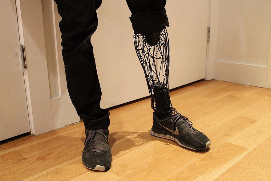 3d printed leg