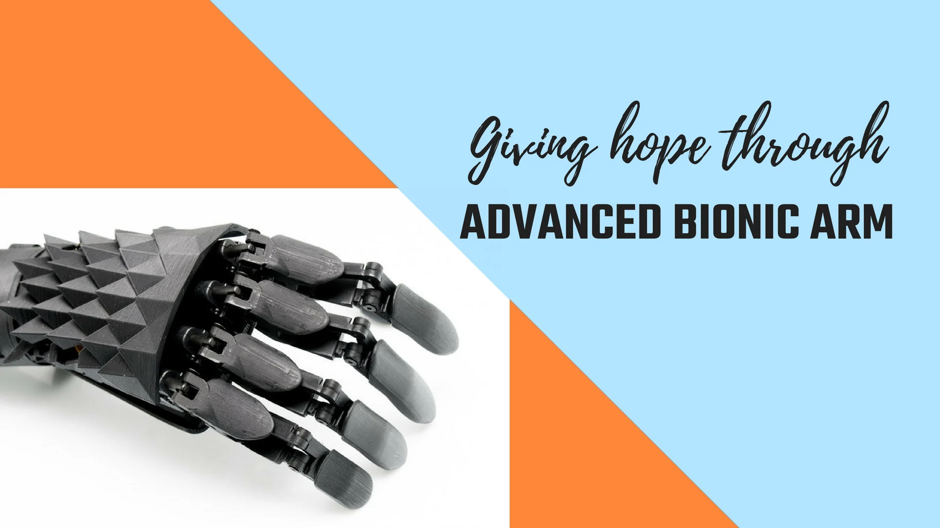 bionic arm