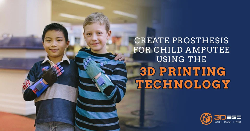 Prosthesis For Child Amputee Resulting In A Better Life 5 Prosthesis For Child Amputee
