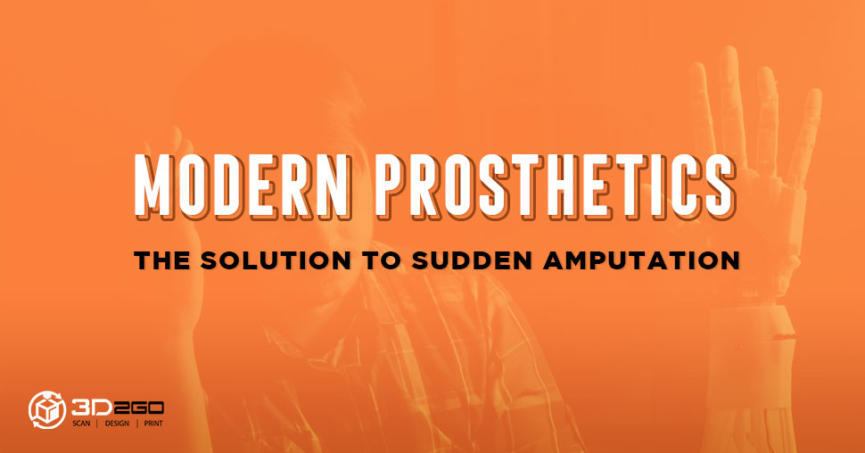 Modern Prosthetics