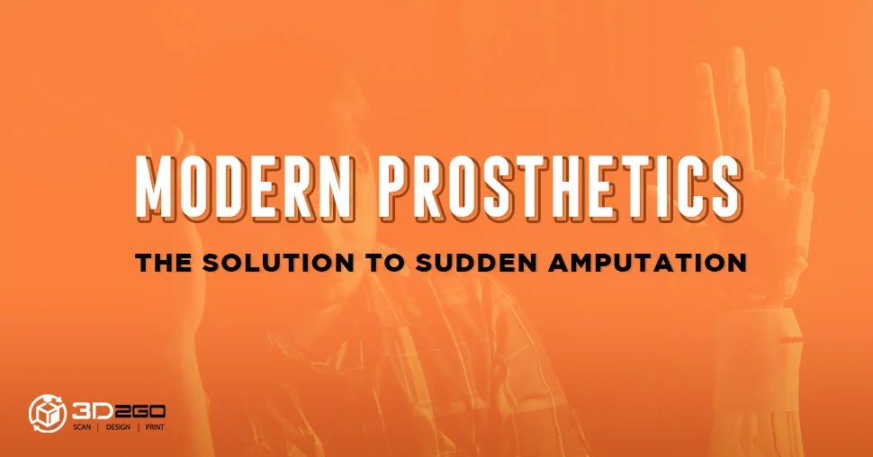 Modern Prosthetics