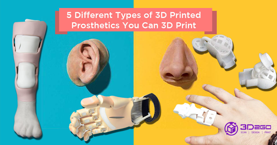 3D Printing Prosthetics