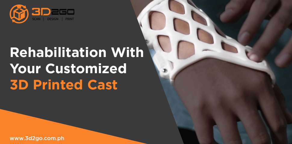 Rehabilitation With Your Customized 3D Printed Cast