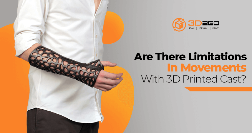 Are There Limitations In Movements With 3D Printed Cast?