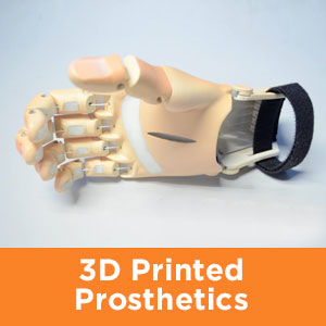 3d printed prosthetic hand