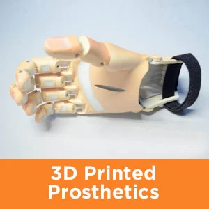 3d printed prosthetic hand